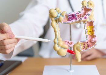 Expertos animan a la participación en el cribado del cáncer de colon, que disminuye la mortalidad hasta un 35%